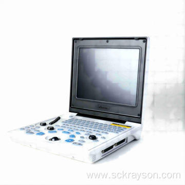 Children gallbladder polyps ultrasound diagnosis instrument